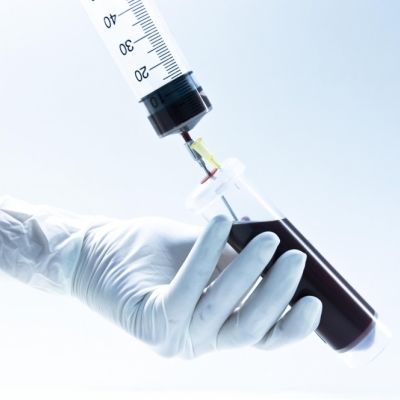 Regenerative medecine