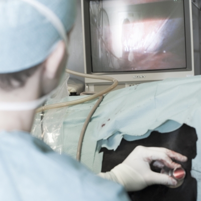 Laparscopy