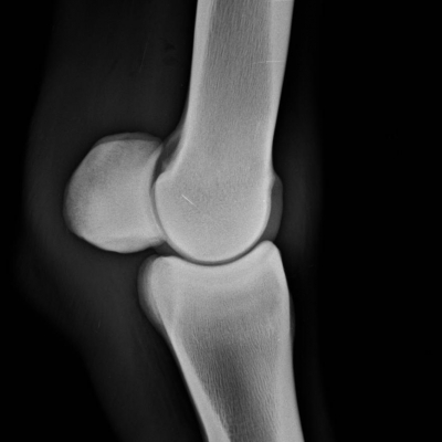 Radiography