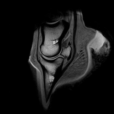 MRI