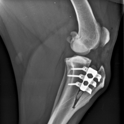 Orthopedics